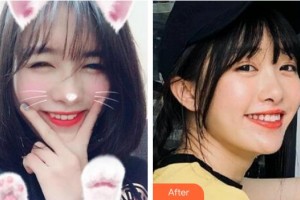 蚌埠三愛口腔門診部鄭永光整形價(jià)格表附冷光美白案例展示