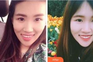 淮南安美口腔門診部承林整形價(jià)格表附牙齒隱形矯正案例展示