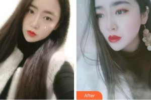 淮北口腔醫(yī)院胡貴飛整形價格表附金屬托槽矯正案例展示