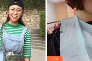 阜陽貝德口腔門診部王世惟整形價格表附牙齒陶瓷矯正案例展示