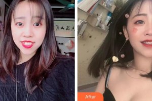 宿州愛牙口腔醫(yī)院韓宇順整形價格表附口腔矯正案例展示