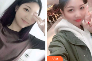 廣州暨博口腔醫(yī)院李艷平整形價格表附牙齒根管調節(jié)案例展示