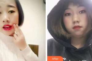 廣州市荔灣區(qū)口腔醫(yī)院魏彤整形價格表附牙齒根管調節(jié)案例展示