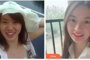 杭州愛琴海醫(yī)療美容醫(yī)院王劍整形價格表附牙齒陶瓷矯正案例展示