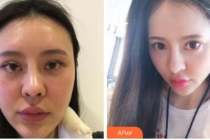 杭州依萱綺醫(yī)療美容診所黃高敏整形價(jià)格表附抗衰老案例展示