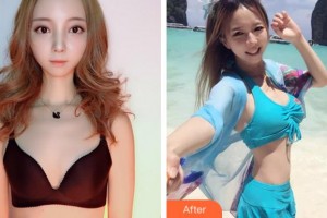 寧波珈禾整形?？漆t(yī)院雷中元整形價格表附自體脂肪隆胸案例展示