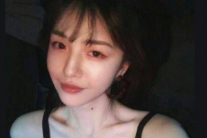 懷化愛(ài)爾眼科醫(yī)院袁小江整形價(jià)格表附光子嫩膚案例展示