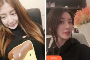 四川圣麗整形美容醫(yī)院李理整形價格表附鼻修復案例展示