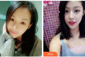 樂(lè)山王玉琨皮膚病?？漆t(yī)院張麗整形價(jià)格表附眼部綜合案例展示