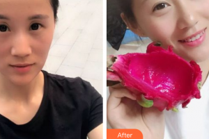 深圳口腔診所吳健雄整形價(jià)格表附冷光美白案例展示