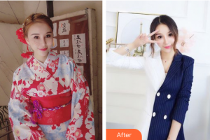 珠?；輴坩t(yī)院整形美容科于燕整形價格表附紅藍(lán)光去痘案例展示