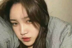 鄭州一美整形美容醫(yī)院陳中整形價格表附切開雙眼皮案例展示