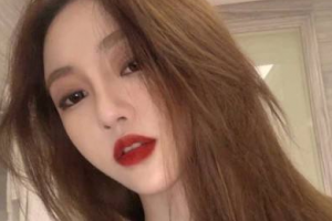 鄭州麗天整形美容醫(yī)院仝茂盛整形價(jià)格表附激光祛斑案例展示