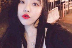 徐州麗珍美容醫(yī)院劉恒力整形價(jià)格表附金屬托槽矯正案例展示