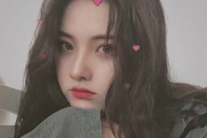 無錫愛思特整形美容醫(yī)院張若梅整形價(jià)格表附切開雙眼皮案例展示