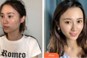 河南大學(xué)附屬南石醫(yī)院燒傷整形美容中心徐文舉整形價格表附皮膚美容案例展示