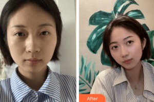 河南整形美容醫(yī)院聶麗麗整形價格表附皮膚美容案例展示