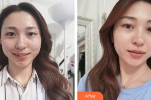 海南省皮膚病醫(yī)院激光整形美容中心李文平整形價格表附皮膚美容案例展示