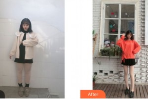 南寧伊晨醫(yī)療美容診所李小慶整形價格表附大腿吸脂案例展示