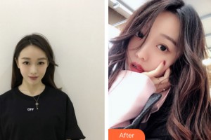 武漢伽美醫(yī)療美容醫(yī)院李瑜蘭整形價(jià)格表附皮膚美容案例展示