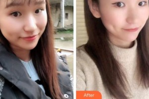曲靖口腔醫(yī)院孟偉整形價格表附牙貼面案例展示