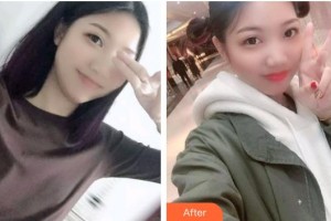 曲靖卓美口腔門(mén)診部陳吉林整形價(jià)格表附根管調(diào)節(jié)案例展示