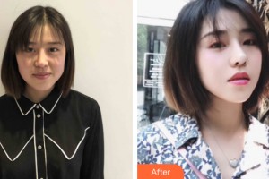 武漢樂(lè)美醫(yī)療美容門診部魏凌華整形價(jià)格表附皮膚美容案例展示
