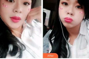 石家莊星源美天醫(yī)療美容醫(yī)院甄翠欣整形價(jià)格表附冷光美白案例展示