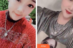 石家莊冀美醫(yī)療美容門(mén)診部王立英整形價(jià)格表附鼻部整形案例展示