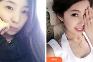 石家莊樂(lè)仁堂萬(wàn)瑞醫(yī)療美容門(mén)診部侯彥博整形價(jià)格表附牙齒隱形矯正案例展示