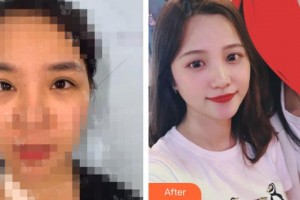 石家莊愛瑞爾醫(yī)療美容診所盧娜整形價格表附祛斑祛痣案例展示