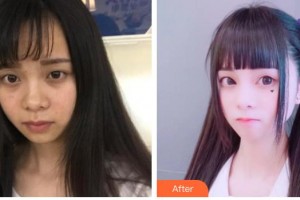 唐山開灤醫(yī)院整形美容中心饒穎慧整形價(jià)格表附激光去黑眼圈案例展示