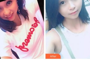 唐山市人民醫(yī)院燒傷整形科張玲整形價格表附眼部綜合案例展示