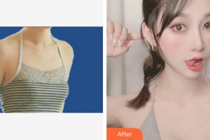 ?？跂|湖醫(yī)學美容整形醫(yī)院周旭剛整形價格表附自體脂肪豐胸案例展示