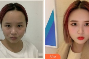 ?？跂|湖醫(yī)學美容整形醫(yī)院梁輝整形價格表附皮膚美容案例展示