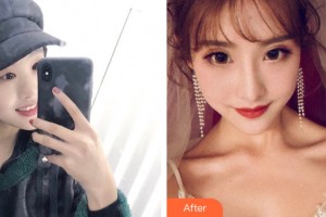 ?？诩t妝尚醫(yī)療美容門診部關海濤整形價格表附眼部手術案例展示