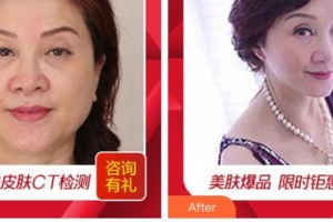 秦皇島紀(jì)輝整形美容醫(yī)院朱改芬整形價格表附皮膚修復(fù)案例展示