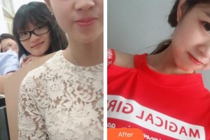 秦皇島愛(ài)爾眼科醫(yī)院錢曼整形價(jià)格表附眼部綜合案例展示