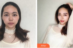 中山百佳婦產(chǎn)醫(yī)院醫(yī)療美容科孫玥玥整形價格表附雙眼皮手術(shù)案例展示