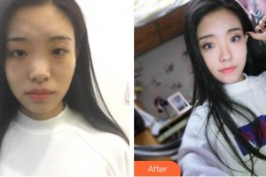 滄州楓華醫(yī)療美容診所林敬華整形價格表附鼻部綜合案例展示