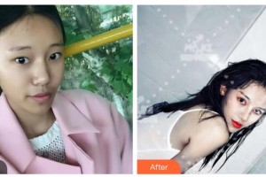山西醫(yī)科大學(xué)附屬太鋼總醫(yī)院燒傷整形中心段鵬整形價(jià)格表附微針美膚案例展示