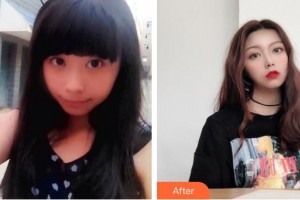 太原美萊整形醫(yī)院樸用三整形價格表附肋軟骨隆鼻案例展示