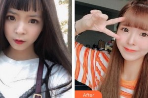 太原晉容整形美容門診部李梅整形價格表附E光嫩膚案例展示