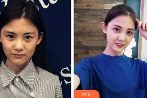 太原晉容整形美容門診部姜春生整形價(jià)格表附超聲提拉案例展示