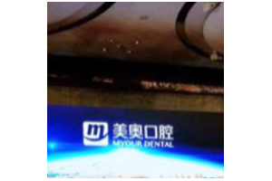 烏魯木齊牙科收費(fèi)標(biāo)準(zhǔn)  烏魯木齊美奧口腔門診牙齒美白恢復(fù)圖