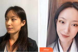柳州醫(yī)伊醫(yī)療美容診所榮耀整形價格表附皮膚美容案例展示