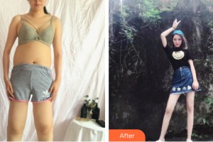 貴陽華美整形美容醫(yī)院田永華整形價格表附大腿吸脂案例展示