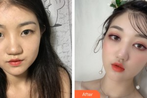 貴陽華美整形美容醫(yī)院杜良軍整形價格表附眼部手術案例展示
