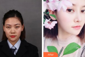 貴陽華美整形美容醫(yī)院李竣福整形價格表附鼻部手術案例展示