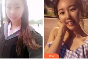 太原星范醫(yī)療美容門診部張清華整形價格表附牙齒陶瓷矯正案例展示